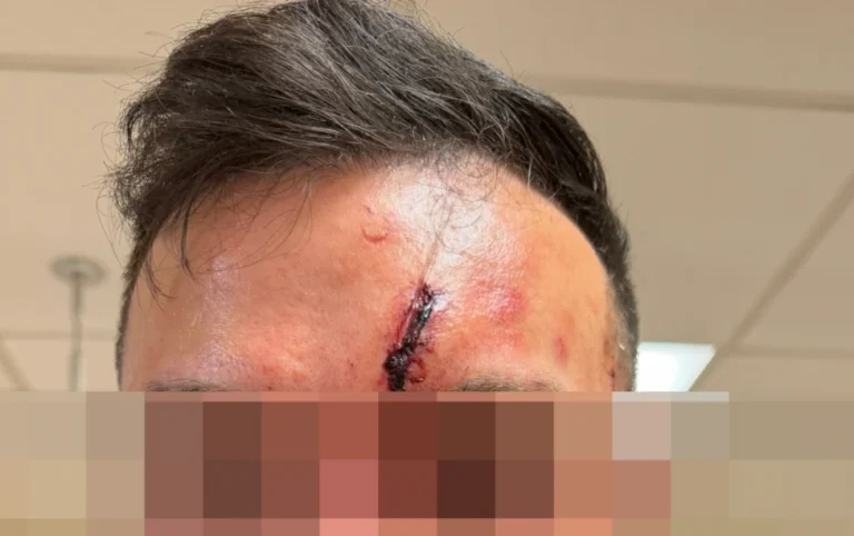 Crypto Investor Recounts Brutal Home Invasion Robbery