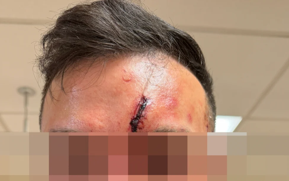 Crypto Investor Recounts Brutal Home Invasion Robbery